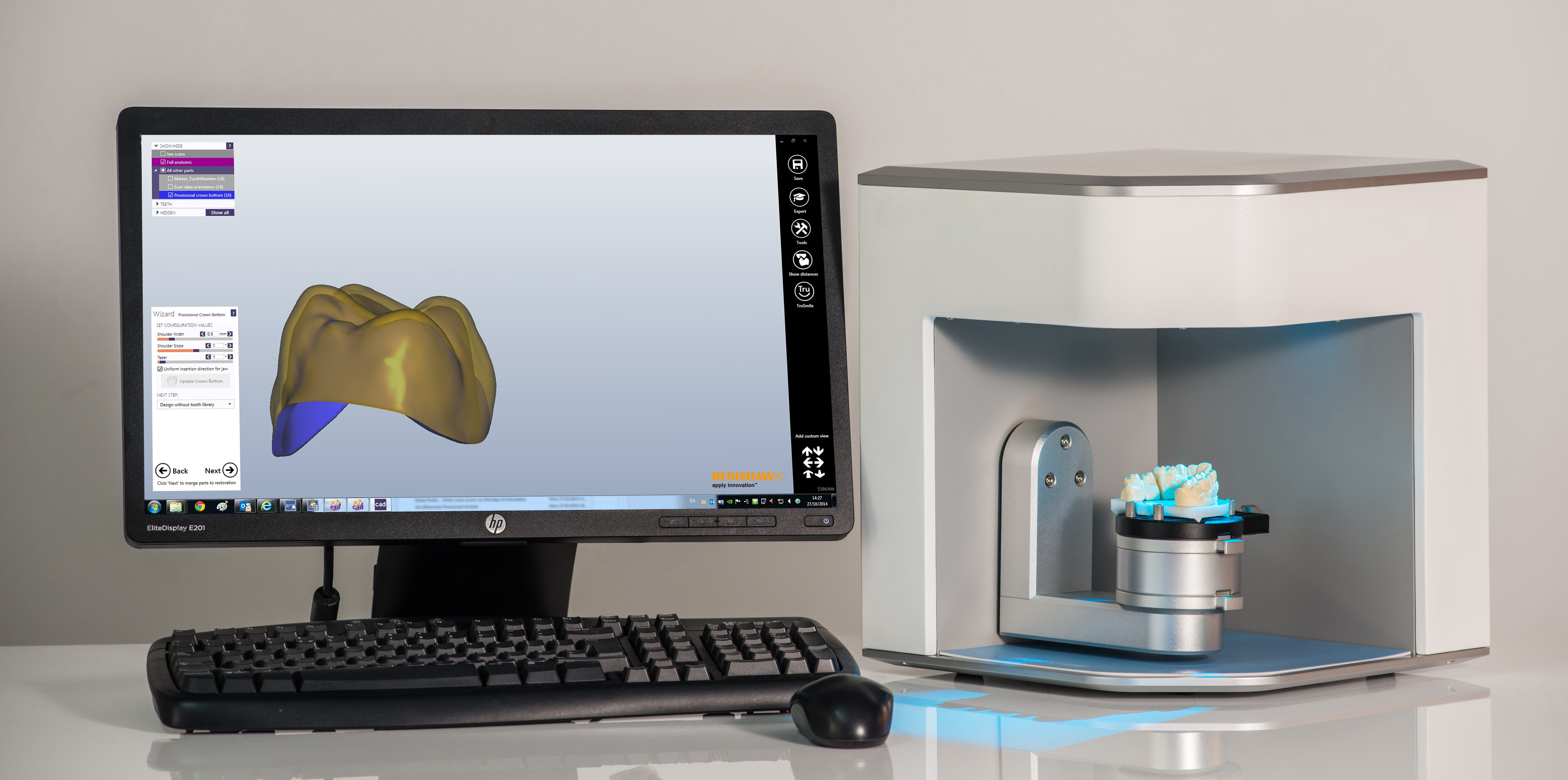 Medit scanner coupled with Renishaw Dental Studio (RDS) for design
